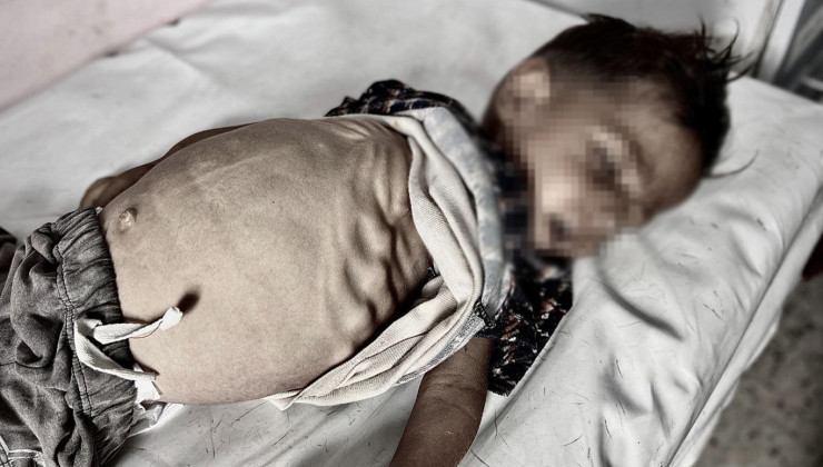 Gazze’de açlıktan ölümler artıyor: 2’si çocuk 4 kişi daha hayatını kaybetti
