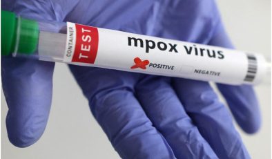 İngiltere’de mpox virüsünün yeni bir türü tespit edildi